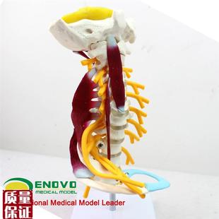 ENOVO颐诺i医学人体颈椎模型颈臂丛神经肌肉模型人体骨骼标本模