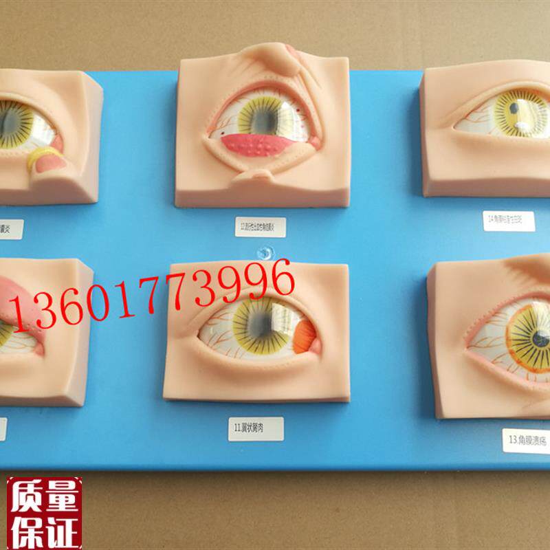 人体常见眼病模型k常用眼科疾病模具眼病模型20种常见眼球病变模