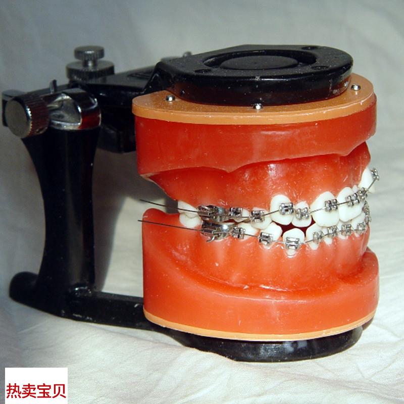 ENOVO颐诺x正畸矫正练习模型