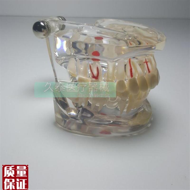 牙齿模型齿e科模型牙科模型口腔模型种植模型教学模型透