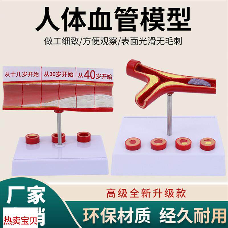 动脉性心血管冠状模型硬化动z脉模型老年心脏模型形成血栓模型