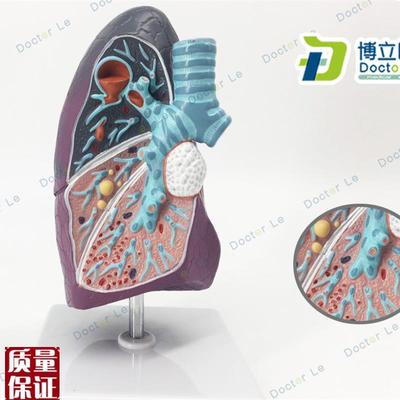 医用人体病理肺l模型内科模型肺模型肺解剖呼吸系统模