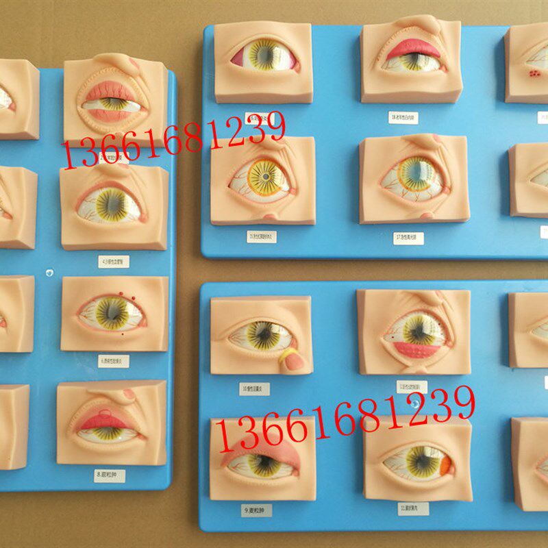 人体常见眼病模型常用眼科疾病模具教学H指导病态眼睛示教标本20