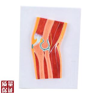 ENOVO颐诺肘关节骨骼肌肉模型D肘关节构造MRI关节解剖骨科教