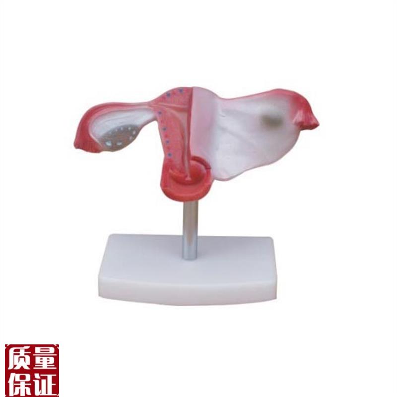 自然大子宫模型女性子宫解剖模型自然大小T子宫解剖教学模