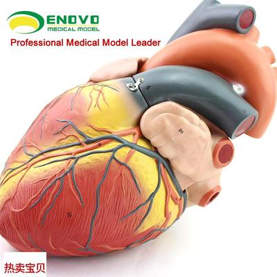颐诺正品放大人体心脏模r型B超彩超声医用心内科心脏解剖教学模型