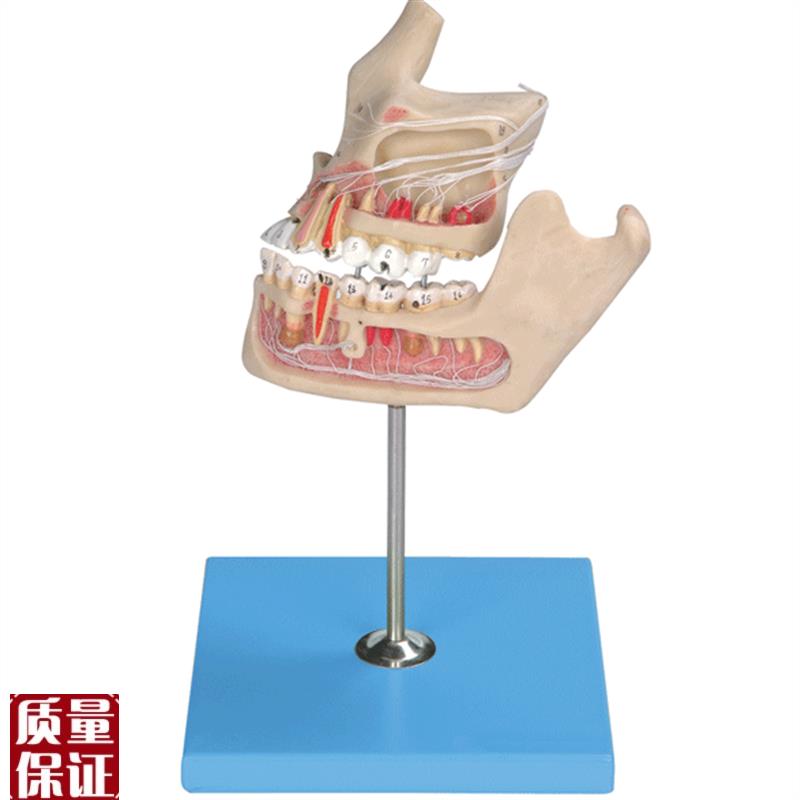 牙体病变模型WB1001