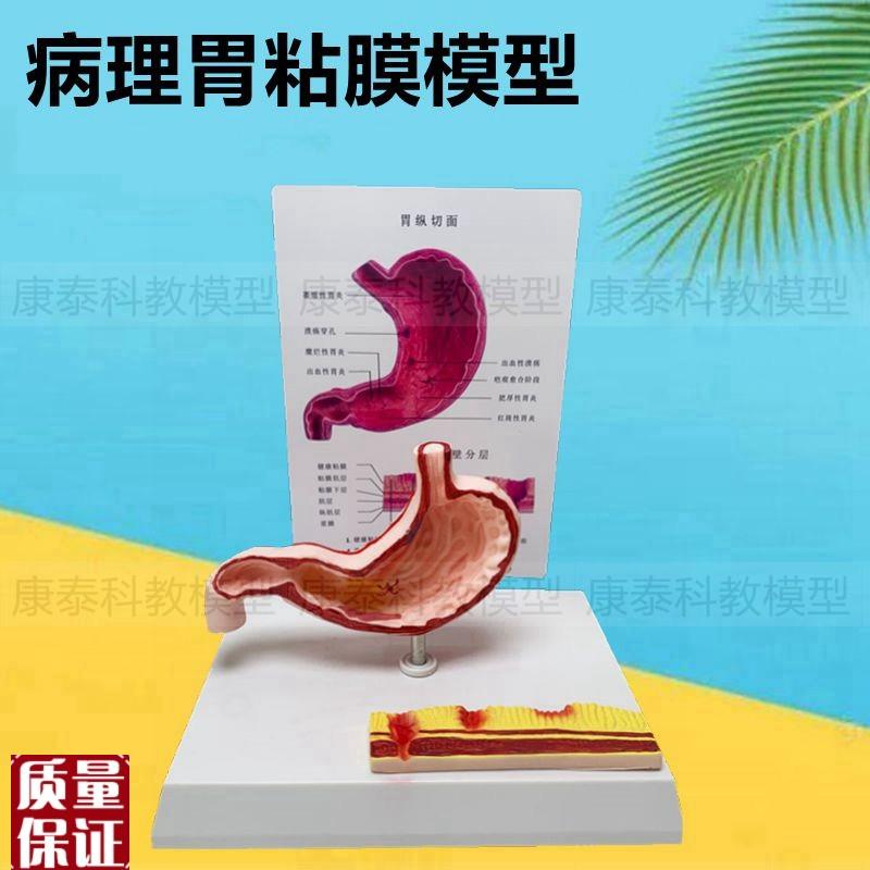 胃粘膜模b型病理孔烂胃壁层次结构血管神经分布贲门幽门消化器官
