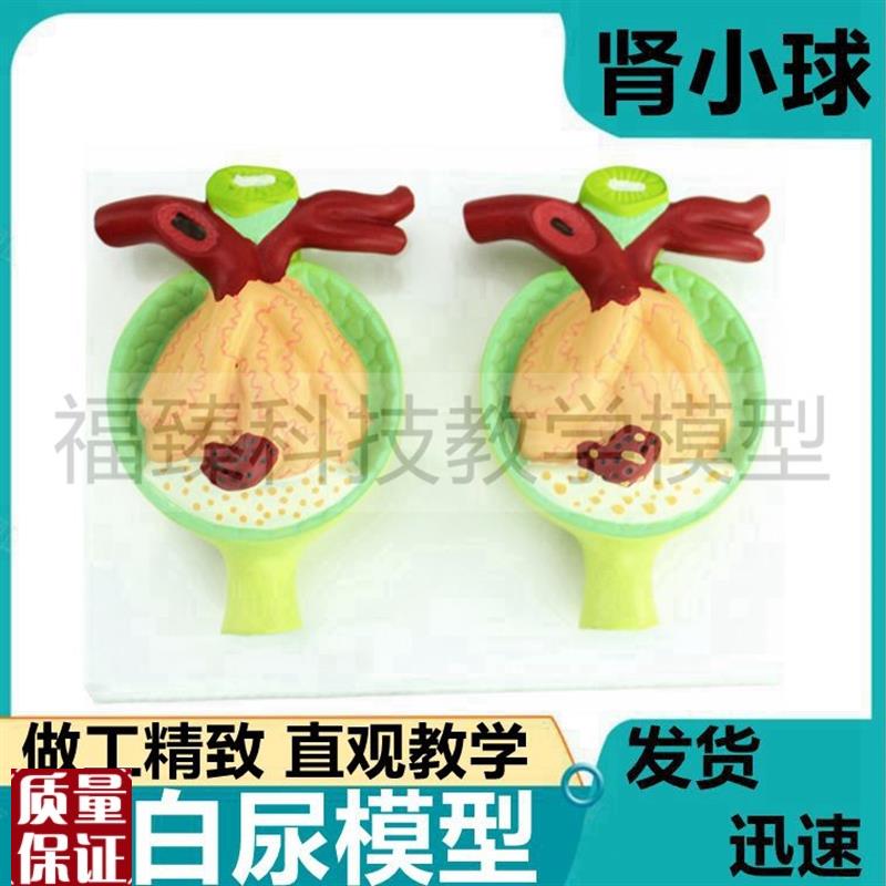 肾小球模型蛋白尿形成病理高压A血液泌尿系肾脏解剖肾上腺动静