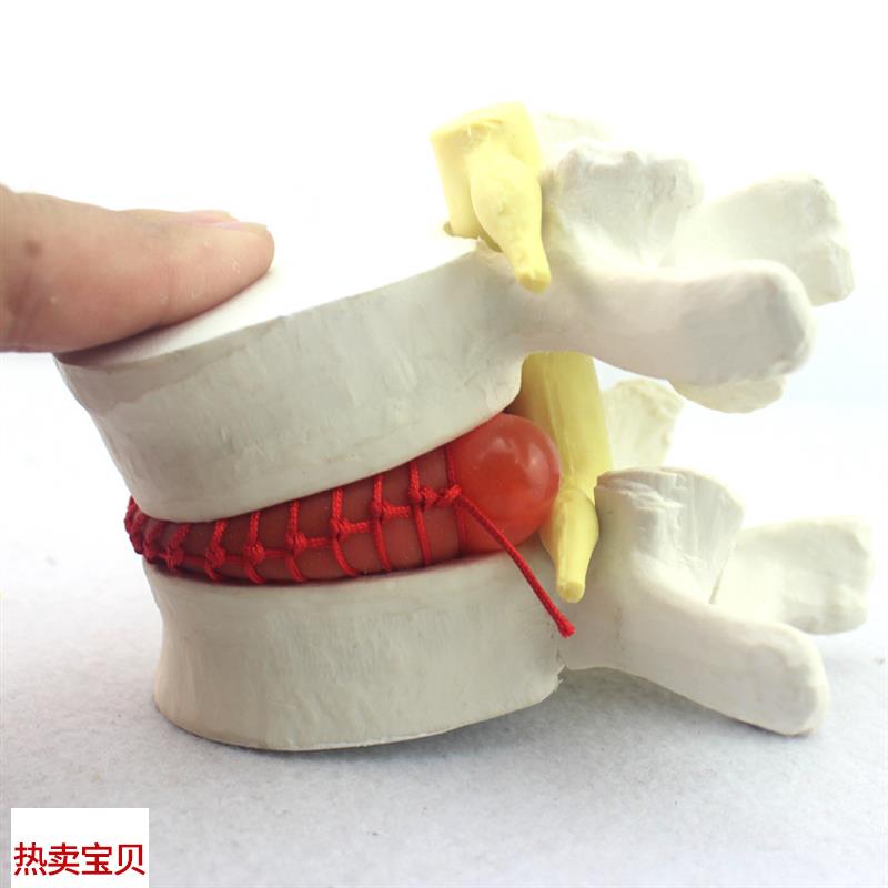 颐诺正品c医用人体腰椎间盘突出演示模型腰椎模型骨科脊柱模型