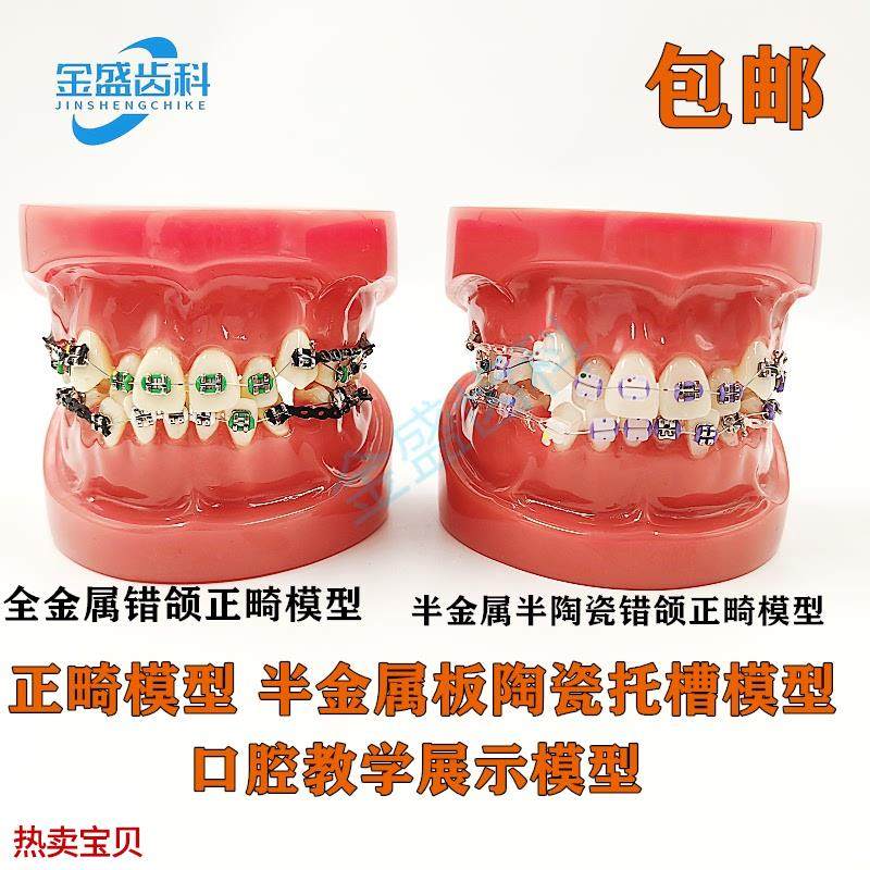 齿科口腔教学模型半金r属半陶瓷托槽正畸模型错颌矫正正畸模型