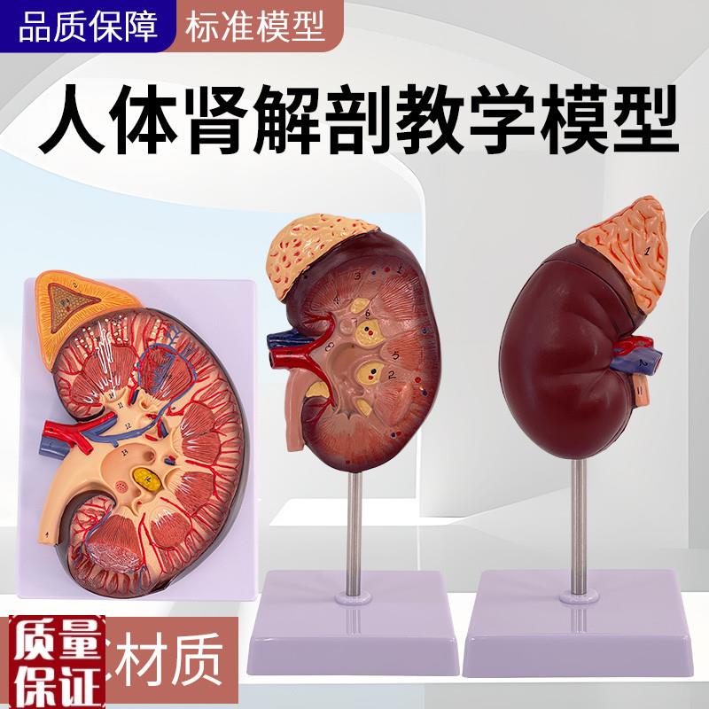 人体肾脏模型肾解剖附肾上腺放大模型病变肾脏U人体内脏器官解