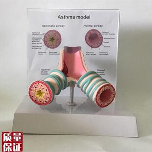 人体哮喘病气管解剖模型支气管模F型医用医学模型教学胸外科教