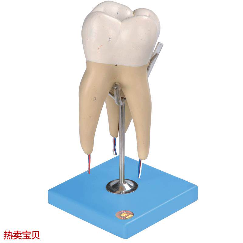 磨牙有三个i牙根模型B10004/5