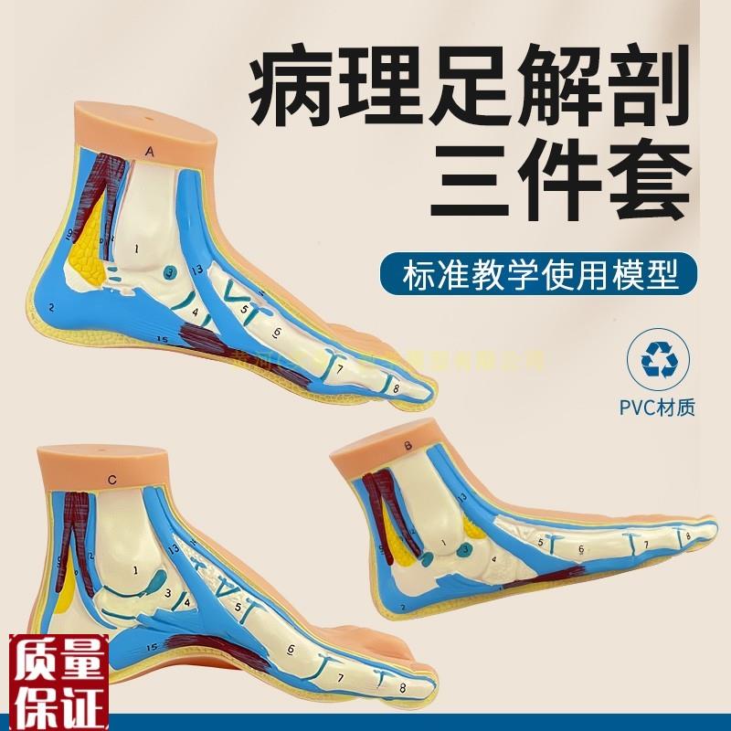 脚模型正b常足扁平足弓型足解剖模型脚部构结构造肌肉血管教学医