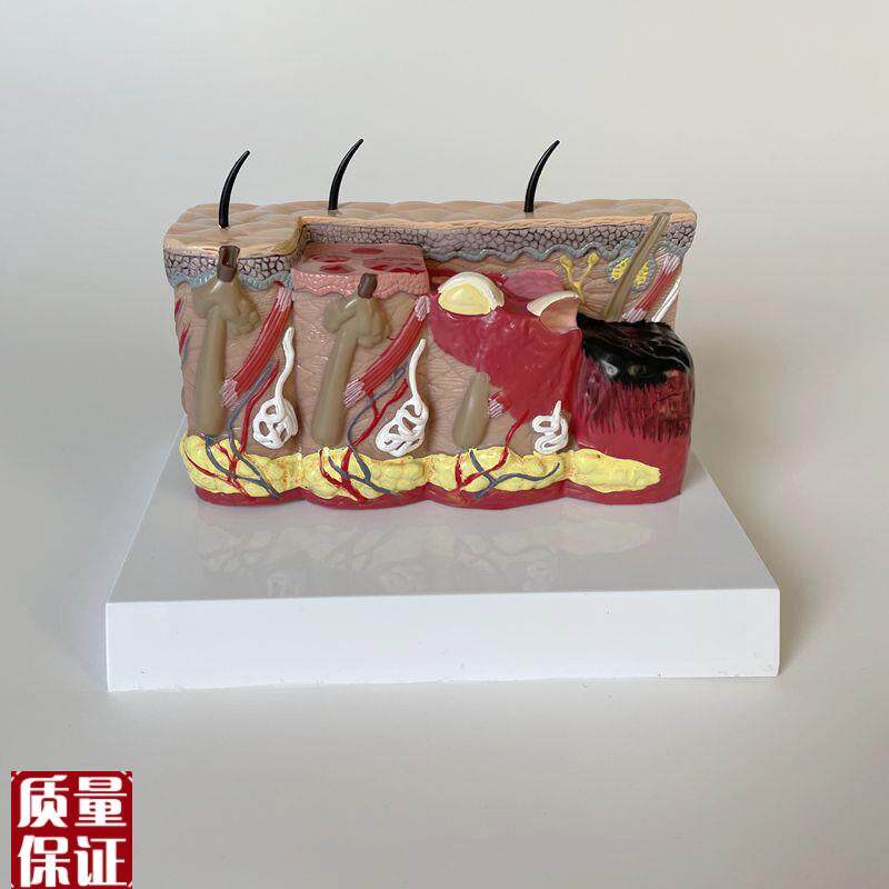 皮肤烧伤程度整形外科病理烫伤C皮下组织变化医美微整形人体皮