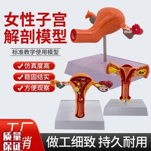人体模型女性f生殖子宫模型阴道卵巢模型教学模具病理变化科学教
