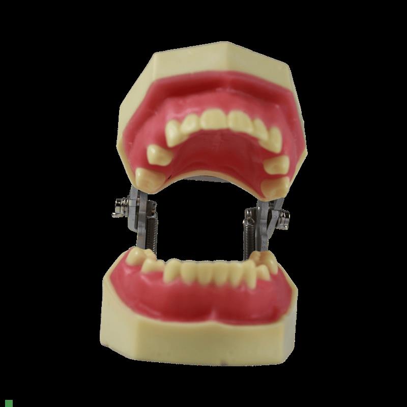 种植模型口腔牙科牙齿模型备牙练习软H牙龈牙模仿真树脂离体缺失