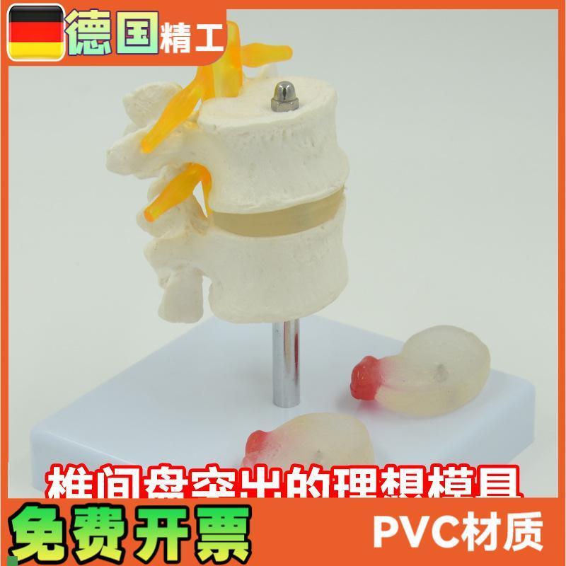 人体腰椎a模型椎间盘脊神经根骨骼解剖医药礼品教学展示用道具