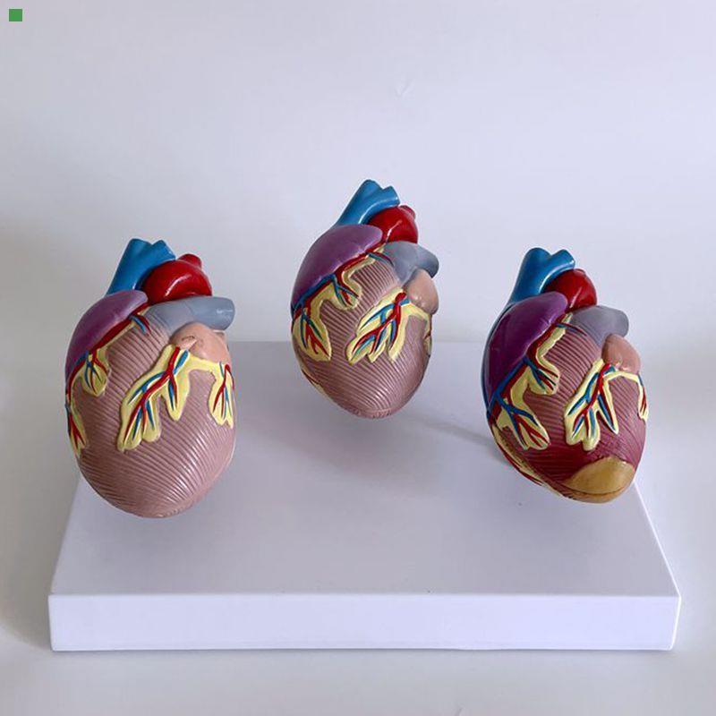 康泰模型人体心脏血管狭窄心房室病理医药促销肥大二尖瓣主动脉瓣