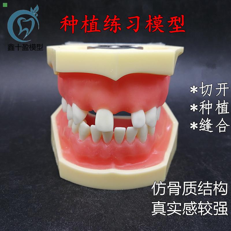 牙科种植上下缺失练习切开种植缝合仿骨质牙齿模型上颌窦提升术