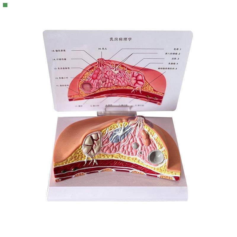 乳房模型乳腺增生家政培训妇产乳腺演示哺乳期乳房构造催乳师教具