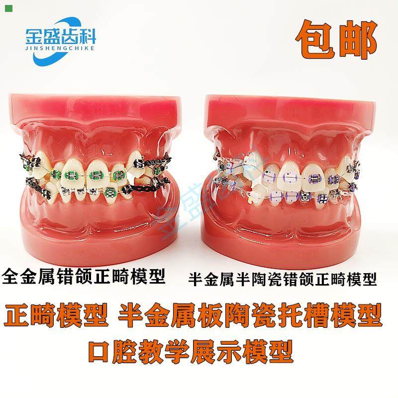 齿科口腔教学模型 半金属半陶瓷托槽正畸模型 错颌矫正正畸模型