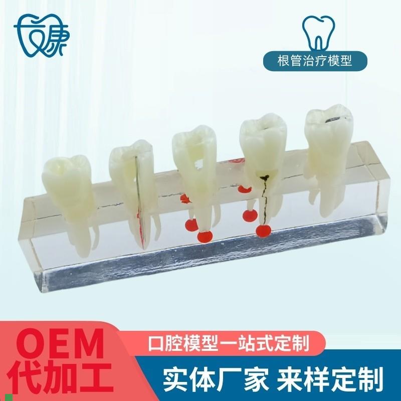 根管牙髓治疗模型牙科口腔教学牙模种植修K复病理模型医患沟通模