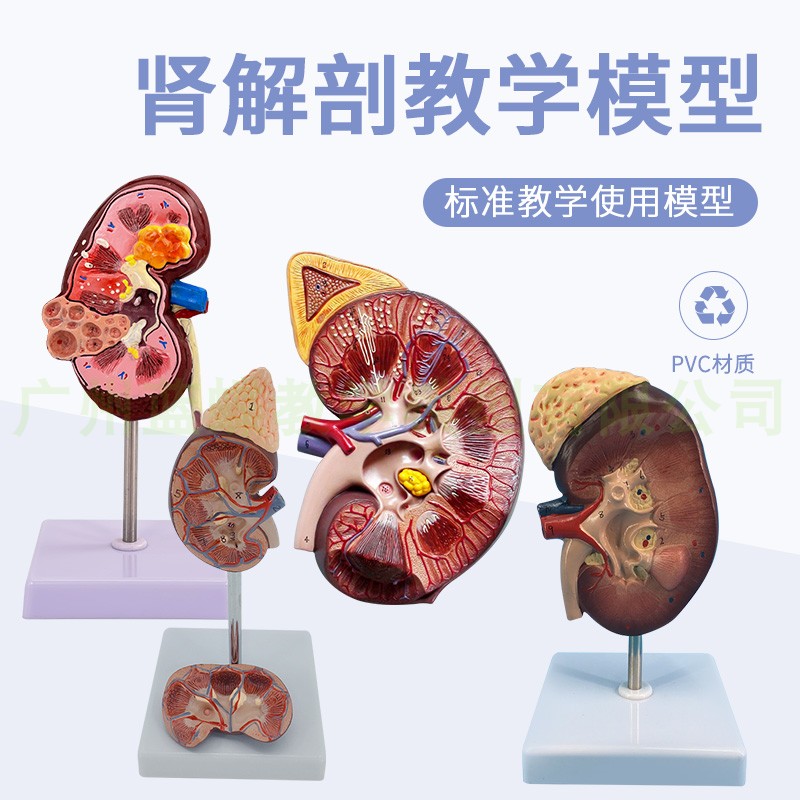人体肾脏模型 肾解剖附肾上腺放大模D型病变肾脏 人体内脏器官解