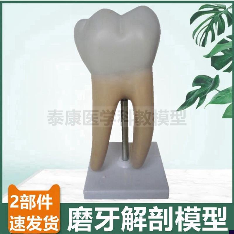 磨牙放大模型臼齿解剖牙根牙髓牙科医生用口腔医药礼品.蛀牙病理