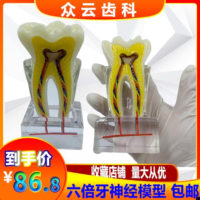 口腔牙科教学教具6倍牙神经模型水晶牙齿结构造解剖U 医患沟通包