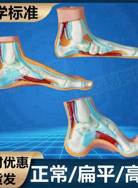 脚模型正常足g弓跟骨拇指足背皮肤肌肉鞋店摆设畸形足扁平高弓病