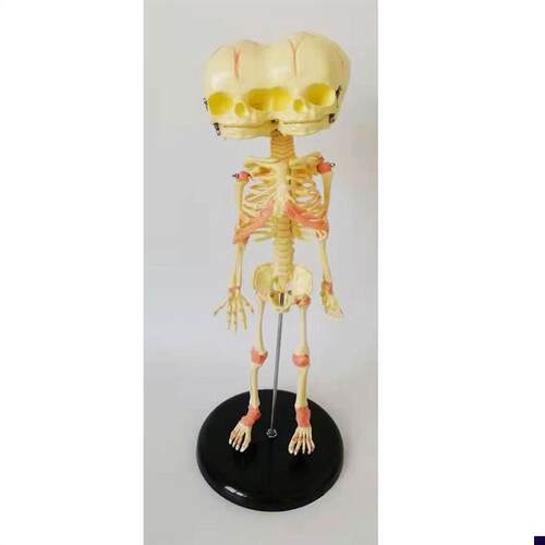 婴儿骷髅模型双头婴儿畸形骨骼y骨架人骨素描人体教学医用教仪新