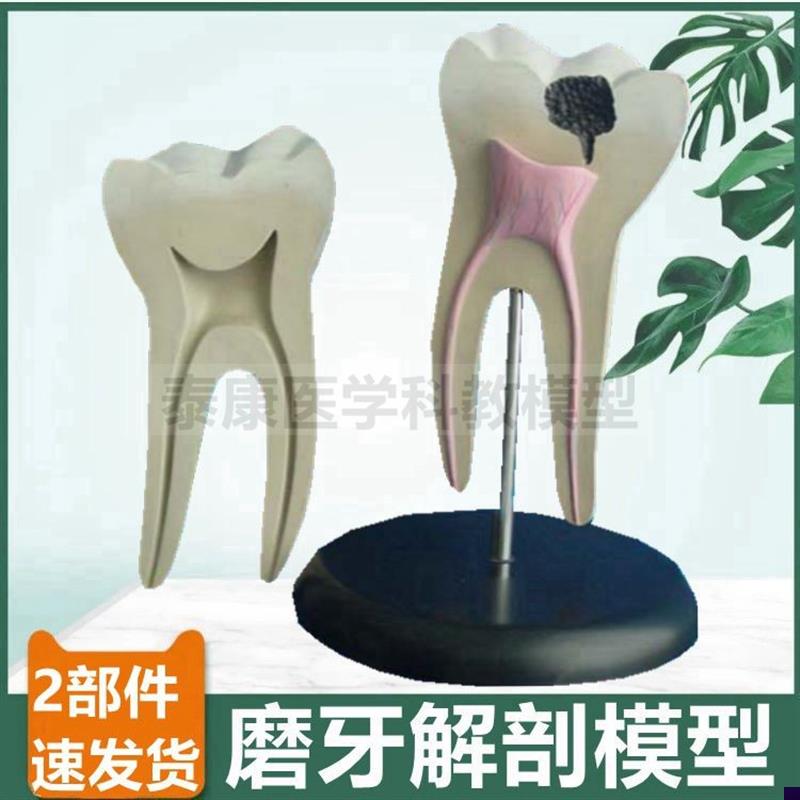 磨牙模型牙科医生l用臼齿大牙病理蛀牙口腔牙齿护理可拆卸牙髓牙