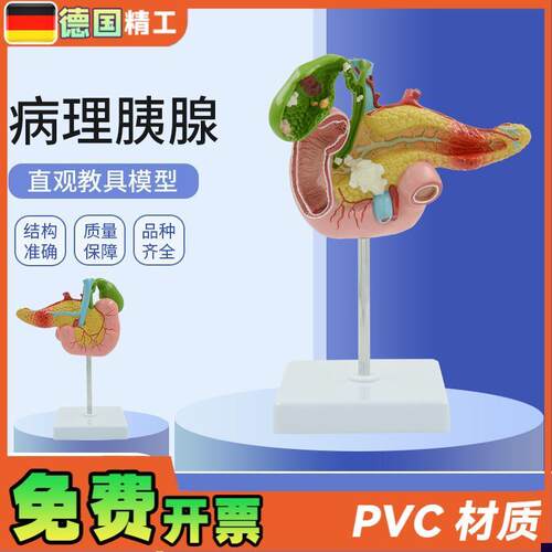 德国】教学仿真 病变胰脾肝胆十二指肠H模型 病理胰腺标本 胰脾肝