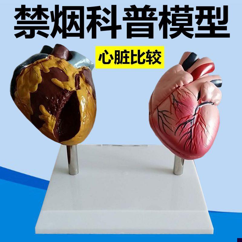 禁烟模型吸烟有害人体脏器功能y心脏血管牙齿呼吸泌尿膀胱女性妊