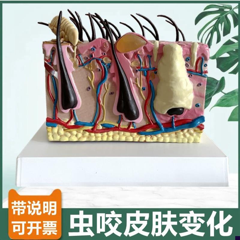 病理皮肤模型 蚊虫叮咬皮肤过程 螨虫人体L皮肤结构毛发毛囊微整