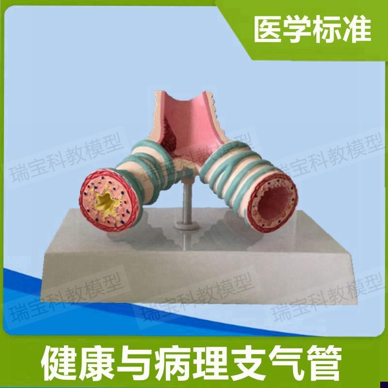 桌上型支气管模型病理哮r老年人呼吸道狭窄医药礼品分泌粘液医用