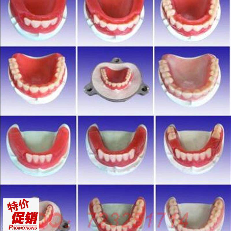 全口牙制作步骤