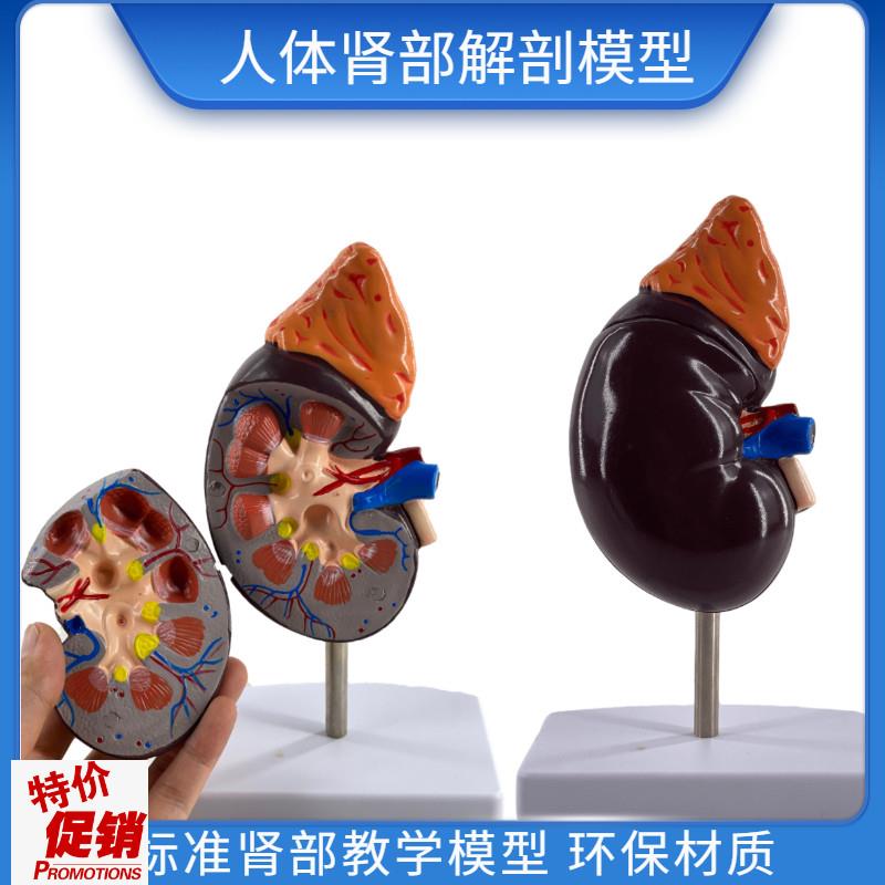 人体肾解剖模型2l部件正常肾脏病理肾部模型专业内脏器官医学教具