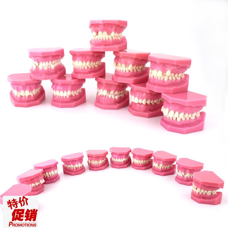 ENOVO颐诺安氏错颌分类模型ANGEL分J类错颌畸形分类演示模型口腔