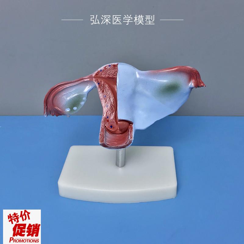 女性子宫模型g人体生殖系统器官解剖卵巢输卵管妇产科医学教学模