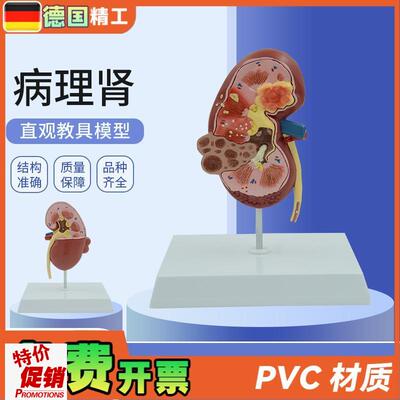 德国人体b肾脏结构病变内脏器官解剖模型泌尿科肾小球肾单位教学