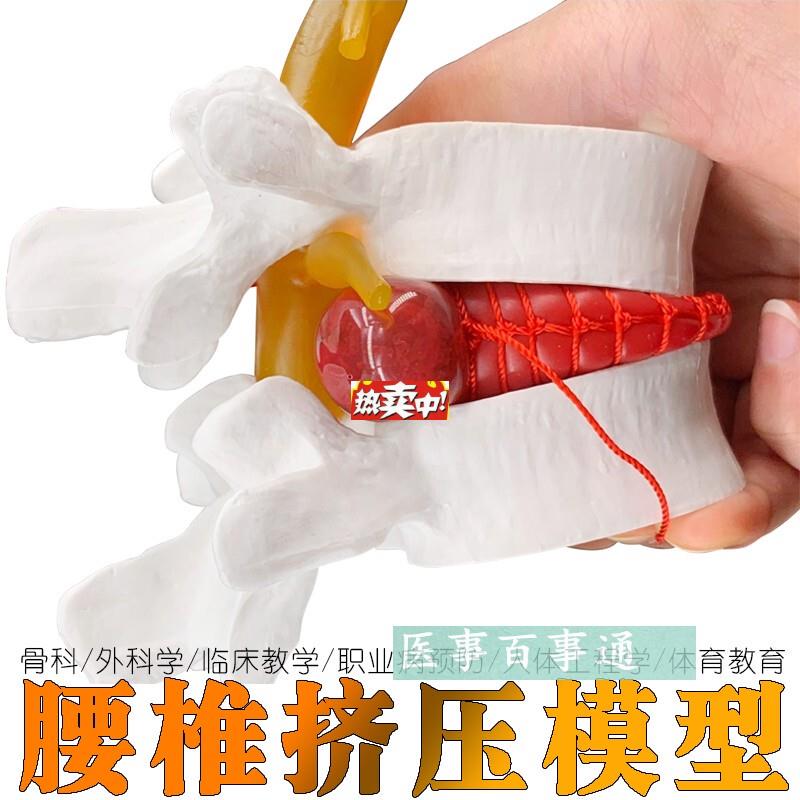 热销正品医用人体腰椎间盘演示模型腰椎模型脊F柱模型脊椎模型包