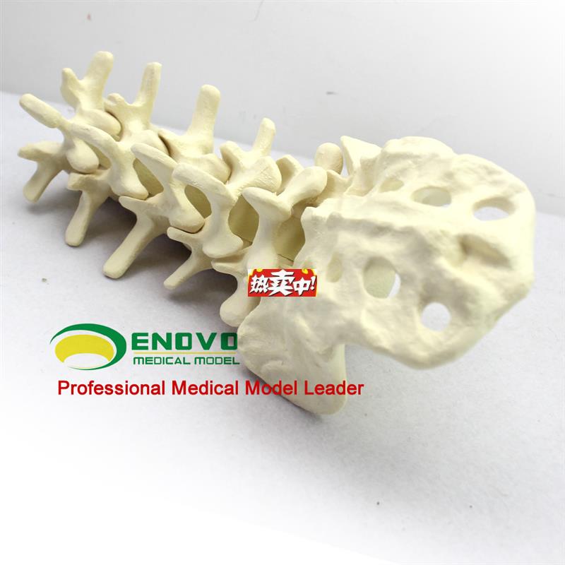 热销骨科术前SawboneL人体腰椎模型人工骨模型骨科手术仿真骨演