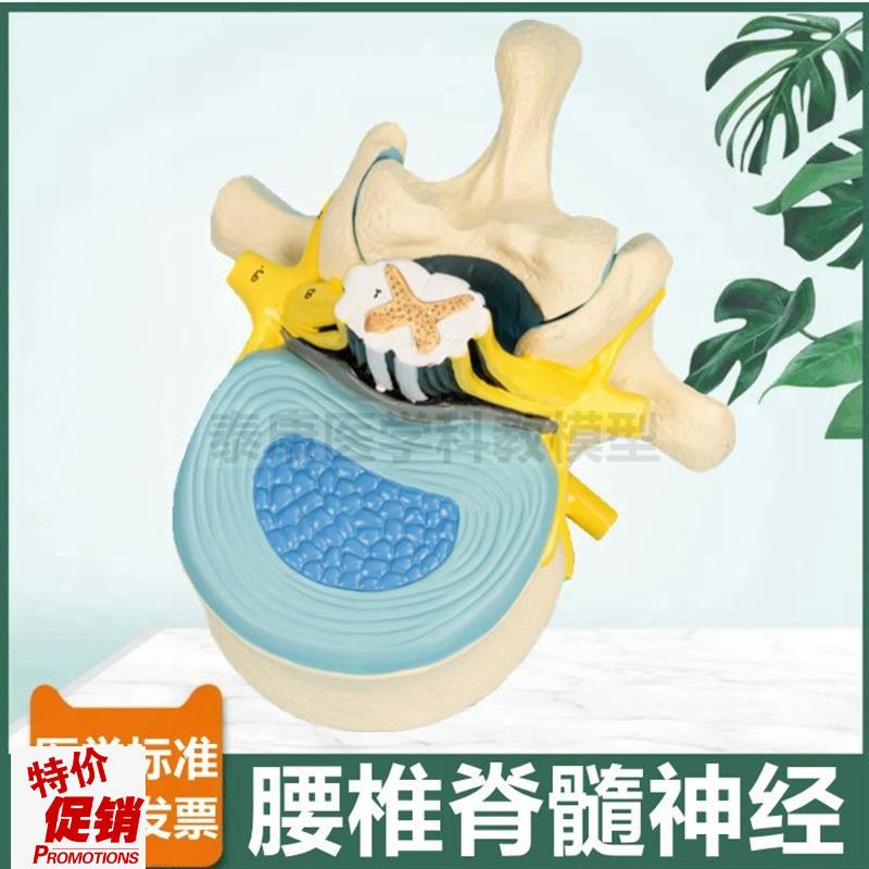 腰椎脊髓解剖模型脊神经根椎管临床麻G醉教学神经节周围椎间盘人