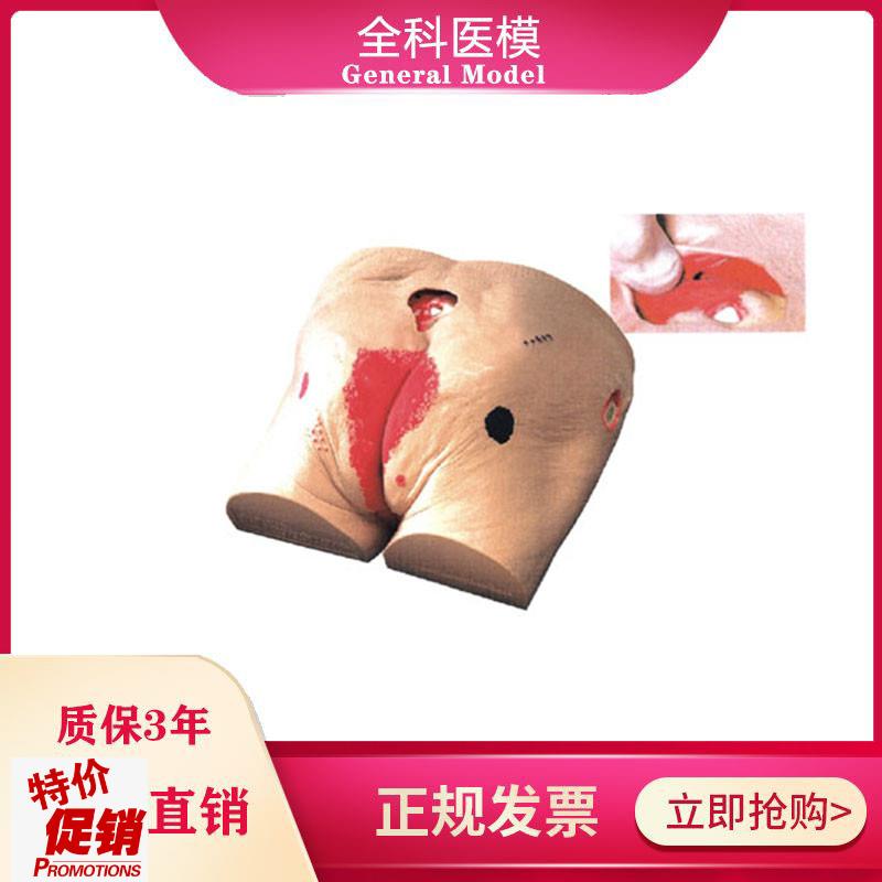 褥疮模型压疮伤i口模型高级老年人压疮褥疮仿真护理模型医教学用