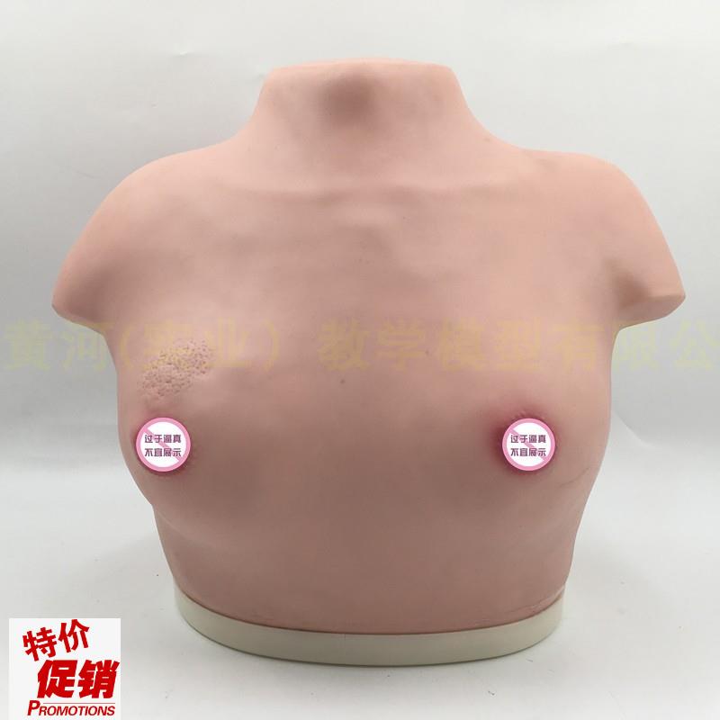 女性乳房乳腺检查l模型高级乳腺视诊与触诊模型医学临床教学模型