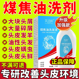 煤焦油洗剂官方旗舰店医用脂溢性皮炎毛囊头屑去屑止痒洗剂洗发水