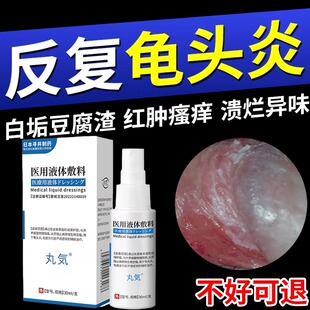 男性龟头炎包皮炎珍珠丘疹冠状沟裂口真菌感染专用豆腐渣白垢喷剂